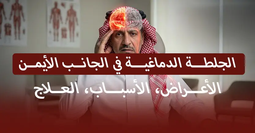 الجلطة الدماغية في الجانب الأيمن: الأعراض، الأسباب، العلاج